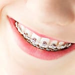 Orthodontics